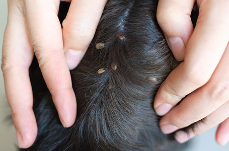 有选择性地在狗皮上 显示大滴答寄生虫的特紧手危险皮肤团体昆虫寄生虫身体宠物吮吸疾病棕色图片