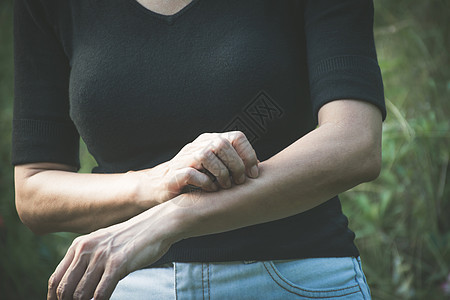 女人用手挠痒痒 抓她的胳膊的女性 健康图片