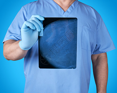 穿蓝色制服和乳胶手套的医生 手持一个Pa的X光片女性治疗放射科x射线解剖学临床诊断x光手术考试图片