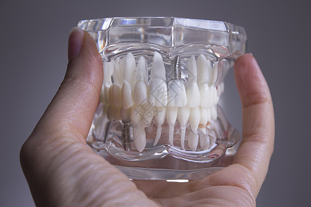妇女用手指假牙实验室微笑女士白色牙科卫生医疗牙医口服假肢图片