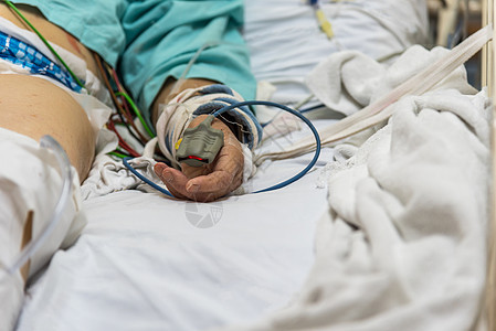 住院病人 手指有脉搏测量仪辅导情况卫生外科诊所保健医院癌症帮助康复图片
