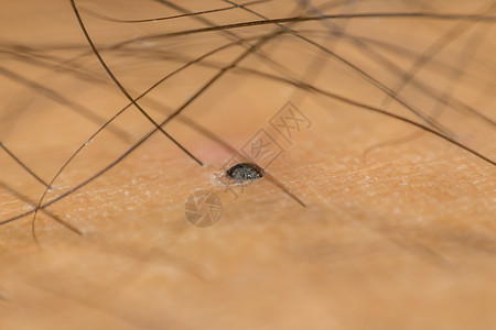 黑发亚洲人干性皮肤宏观肤色生活男性皱纹细胞器官毛孔皮肤科男人身体图片