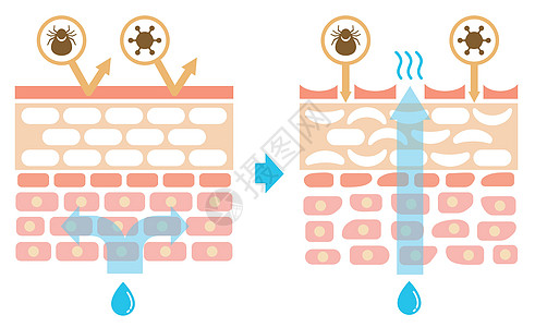 皮肤剖面图 健康皮肤与受伤皮肤保护效果对比图皮肤科身体卫生细胞治疗过敏保健真皮表皮横截面图片