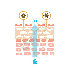 皮肤剖面图解剖学病毒高清图片