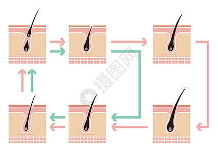 正常毛发周期与AGA雄激素性脱发的对比图沙龙药品头发插图生长损失休止期保健皮肤化期图片