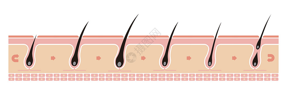 正常的头发周期它制作图案插图头皮乳突损失生长期灯泡解剖学化期药品真皮图片