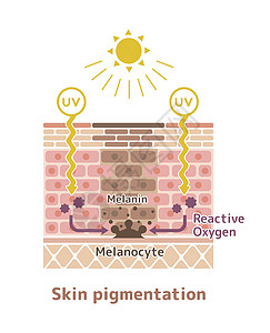 皮肤色素沉着皮肤斑点图案制作机制插图紫外线卫生表皮黑色素信息皮肤科角质层科学治疗图片
