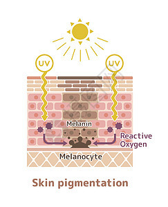 皮肤色素沉着皮肤斑点图案制作机制插图紫外线卫生表皮黑色素信息皮肤科角质层科学治疗图片