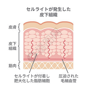 脂肪团皮肤它制作图案护理插图胶原治疗身体女士饮食卫生绘画生物学图片