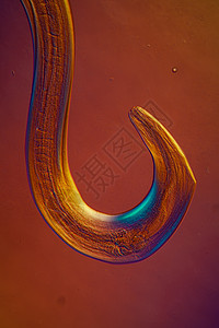 微生物底部的氧化性寄生虫100x宏观科学口器考试弯曲害虫蛲虫疾病黑头蠕虫图片