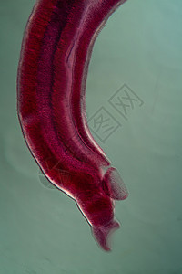 显微镜下bilhazizois病原体的对等凝胶图片