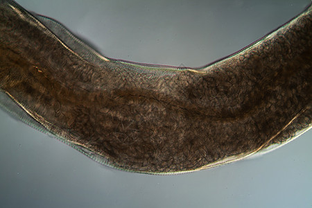 微生物底部的氧化性寄生虫100x蠕虫害虫考试感染口器黑头弯曲宏观疾病钩虫图片