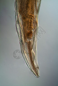 微生物底部的氧化性寄生虫100x钩虫宏观害虫疾病弯曲口器科学考试蛲虫黑头图片