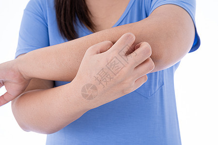 女性在孤立的白色背景上抓着她的手臂 医疗 为广告概念提供保健湿疹疾病身体手指皮肤划痕手腕男人皮疹成人图片