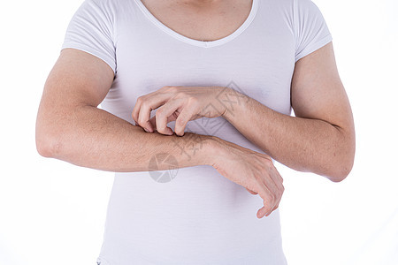 男性在孤立的白色背景上抓着他的手臂 医疗 为广告概念提供保健手腕女性皮炎疼痛治疗划痕女士疾病发痒皮疹图片