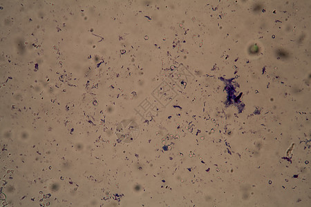 显微镜下叶子上的细菌a图片