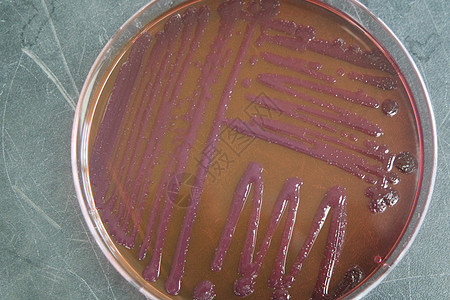 含有各种细菌菌群的贝特利菜殖民地微生物器皿盘子细菌学化验技术微生物学文化病原图片