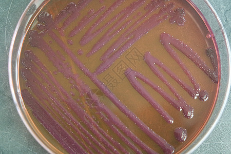 含有各种细菌菌群的贝特利菜盘子生物学样本殖民地微生物学临床微生物生物病菌抗生素图片