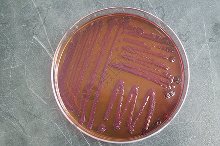 含有各种细菌菌群的贝特利菜病菌微生物学实验室病理生物学殖民地群落样本临床细菌图片