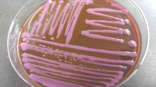 细菌学含有各种细菌聚积在agar上生长文化临床菌类盘子病原实验室抗菌剂化验生物学背景
