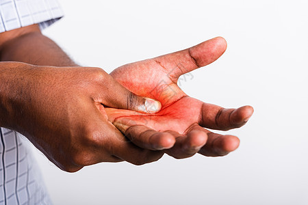 黑人握着手掌受伤 感觉疼痛办公室棕榈障碍手势痛苦神经风湿病隧道手腕手术图片