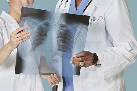 分析X光报告的保健专业人员的中流医疗部门人员医院从业者放射科办公室x射线专家诊所检查谐振审查图片