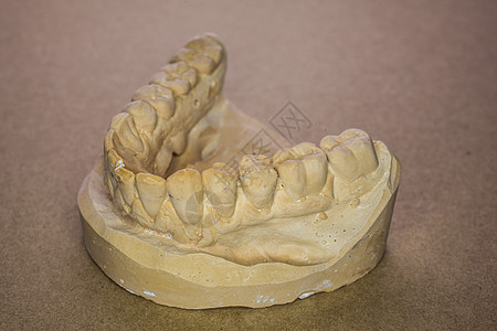 乌德基费尔阿卜杜鲁克上颚部分牙印牙科下颌牙医臼齿门牙牙列假牙图片