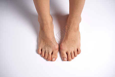 女性双腿上事故状况痛苦药品解剖学脚趾疗法整脊疼痛指甲图片