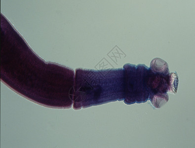 显微镜下有四肢的虫图片