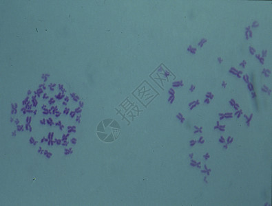 细胞核心中的染色体紫色诊断宏观物质遗传药品考试医生实体疾病图片