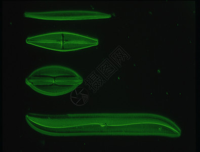 100x 显微镜下的海洋对流器绿色穷人浮游黑色硅藻海藻圆形生物藻类宏观图片