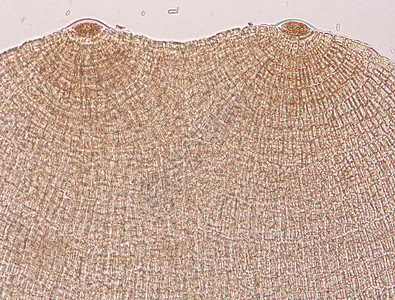 在显微镜100x下海藻的二缺星二分血孔虫竹荪褐藻藻类海水组织水生植物宏观圆形细胞棕色图片