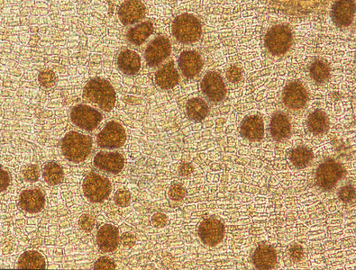 在显微镜100x下海藻的二缺星二分血孔虫海水藻类组织水生植物竹荪棕色宏观褐藻圆形细胞图片