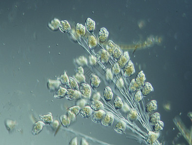 显微镜下水滴中的硅和亚米巴斯池塘纤毛虫浮游宏观水池生物液泡游泳图片