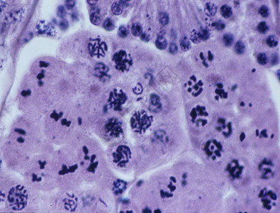 细胞核心中的染色体实体医生药品物质诊断疾病宏观考试紫色遗传图片