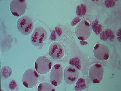 细胞核心中的染色体遗传疾病紫色药品物质诊断宏观医生实体考试图片