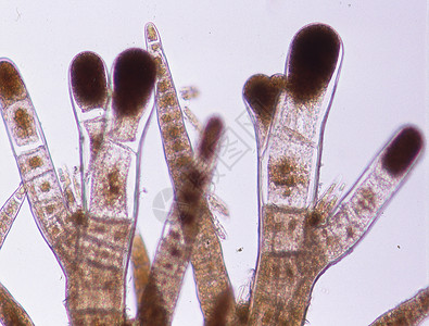 海海水红藻 附带影响盐水水生植物组织细胞宏观胸膜光合作用藻类叶状体后果图片