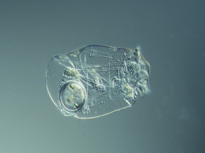 在显微镜下水中游泳的机器人水滴池塘纤毛虫液泡浮游生物水池宏观图片