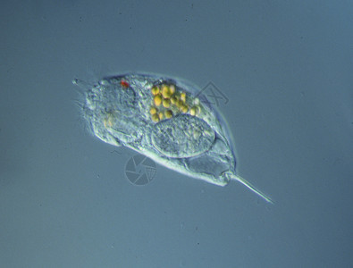 在显微镜下水中游泳的机器人液泡水滴宏观生物纤毛虫浮游池塘水池图片