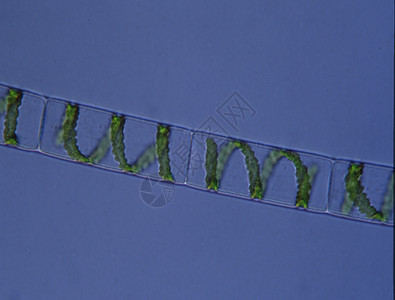 在显微镜下螺旋藻图片