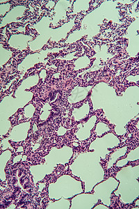 显微镜下的肺部 100x科学组织学果皮考试细胞组织宏观老兵医药诊断背景图片