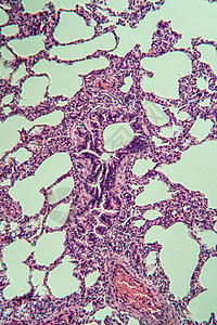 显微镜下的肺部 100x考试医生果皮专用诊断组织细胞组织学药品科学背景图片