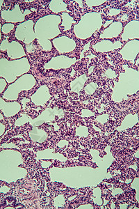 显微镜下的肺部 100x专用诊断医生考试药品医药果皮宏观科学细胞图片