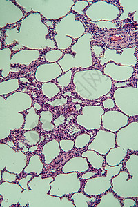 显微镜下的肺部 100x宏观医生组织学科学考试专用医药诊断组织细胞图片