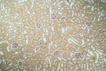 显微镜下的肾脏皮层 100x诊断肾小球单位组织学专用医药组织考试康复药品背景图片
