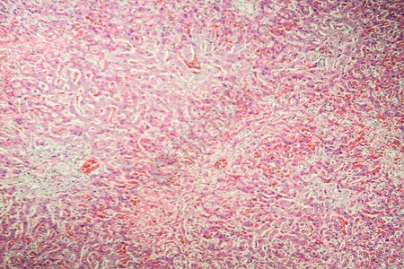 意外休克后肝猪肾科学诊断药品考试宏观组织学组织刺猬震惊疾病背景图片