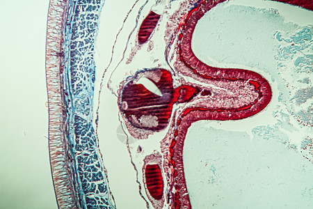 第10部分第100节的地虫病理学横截面诊断肌肉宏观考试科学调查组织学蚯蚓蠕虫图片