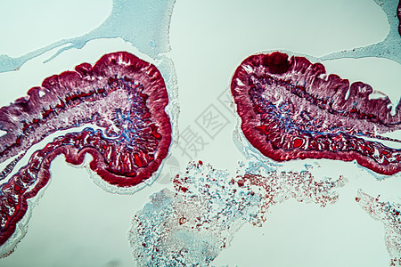 第10部分第100节的地虫病理学横截面组织宏观蠕虫药品考试诊断调查组织学肌肉图片