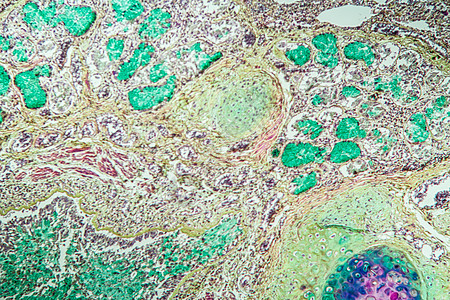 米克罗斯科普100x 古韦德直达米克罗科普病理肺部宏观组织学组织哮喘调查诊断科学康复图片