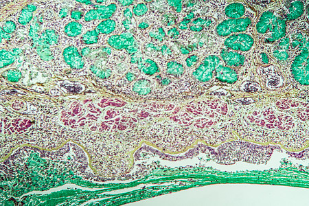 米克罗斯科普100x 古韦德直达米克罗科普组织科学康复疾病诊断肺部宏观组织学病理哮喘图片